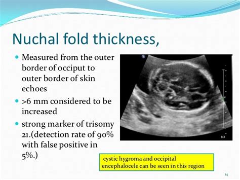 nuchal fold thickness normal measurement|nuchal fold measurement 20 weeks.